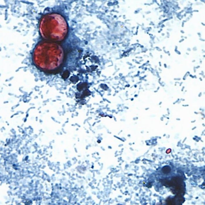 EU reporta dos muertes por ciclosporiasis en Michigan durante brote intestinal